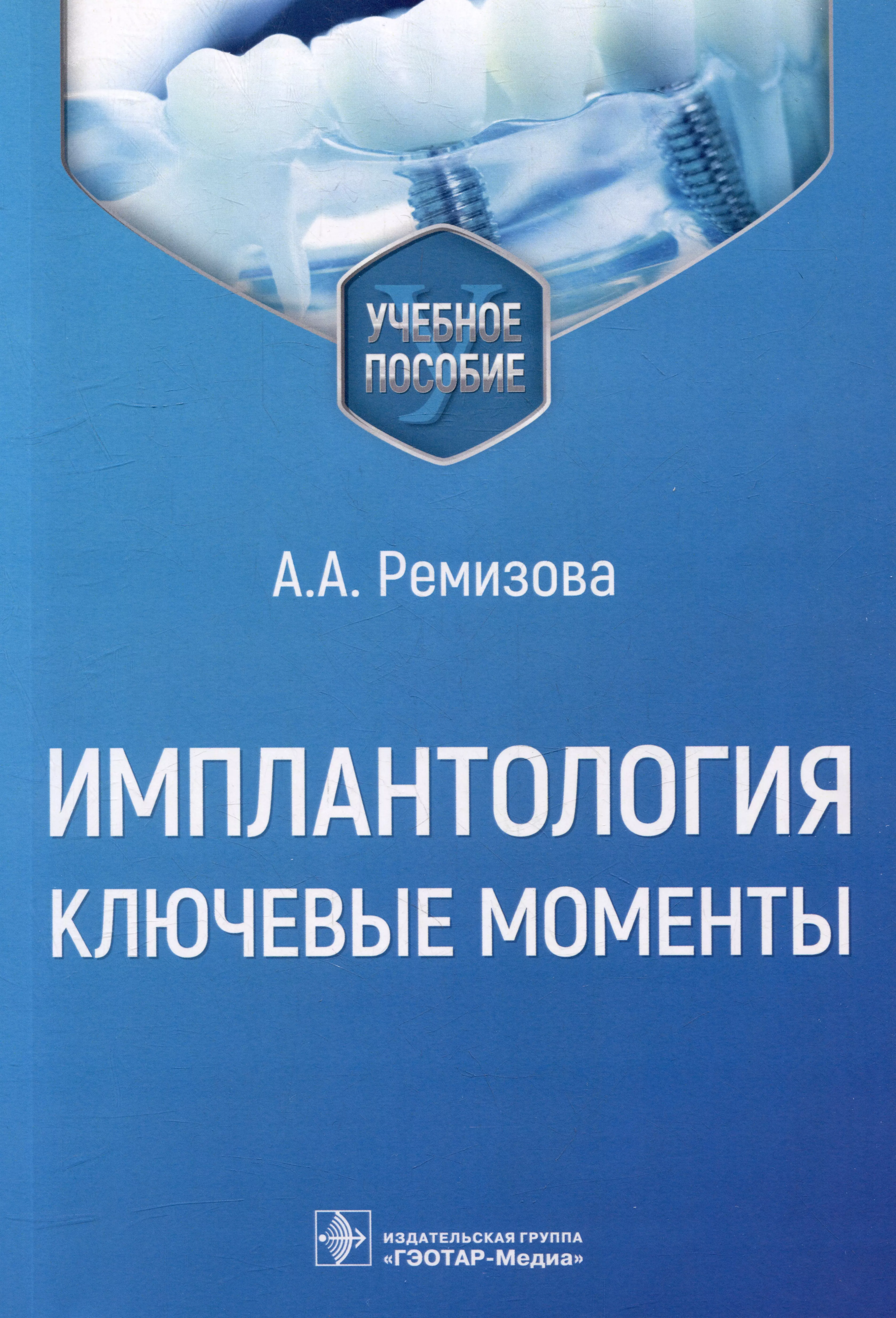 Ремизова Анна Александровна - Имплантология: ключевые моменты: учебное пособие