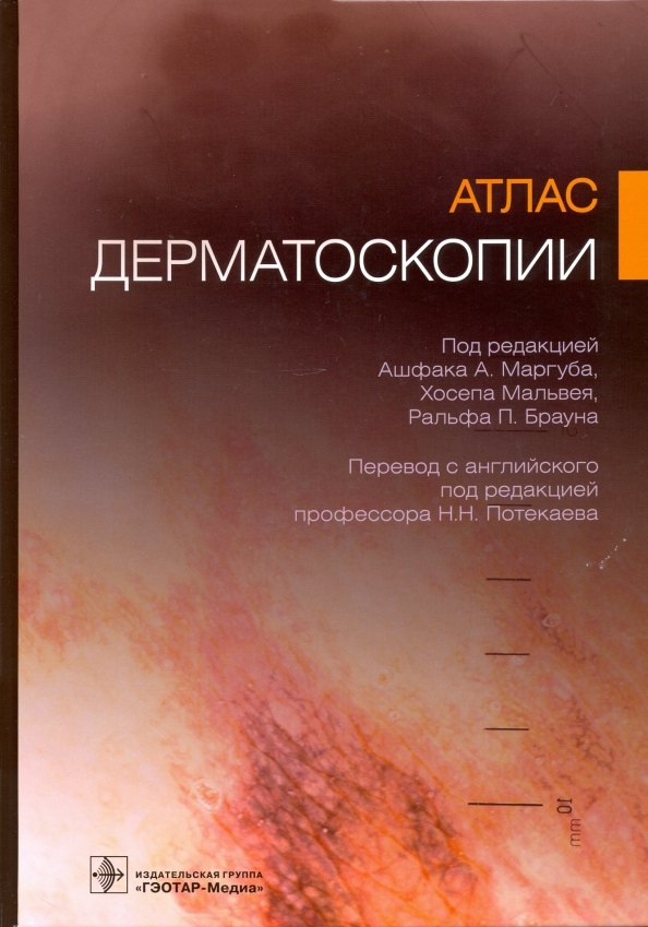 

Атлас дерматоскопии
