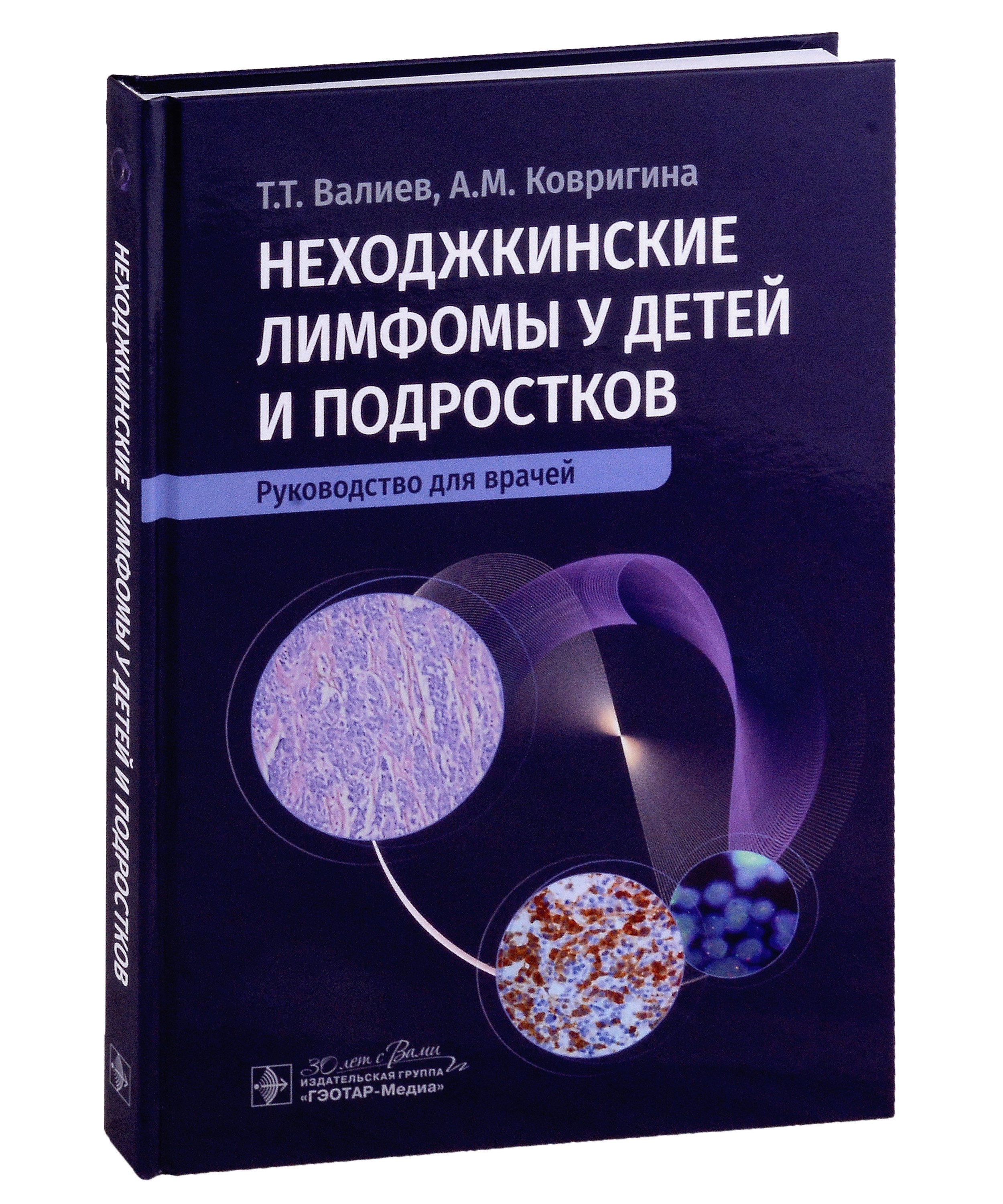 

Неходжкинские лимфомы у детей и подростков: руководство для врачей