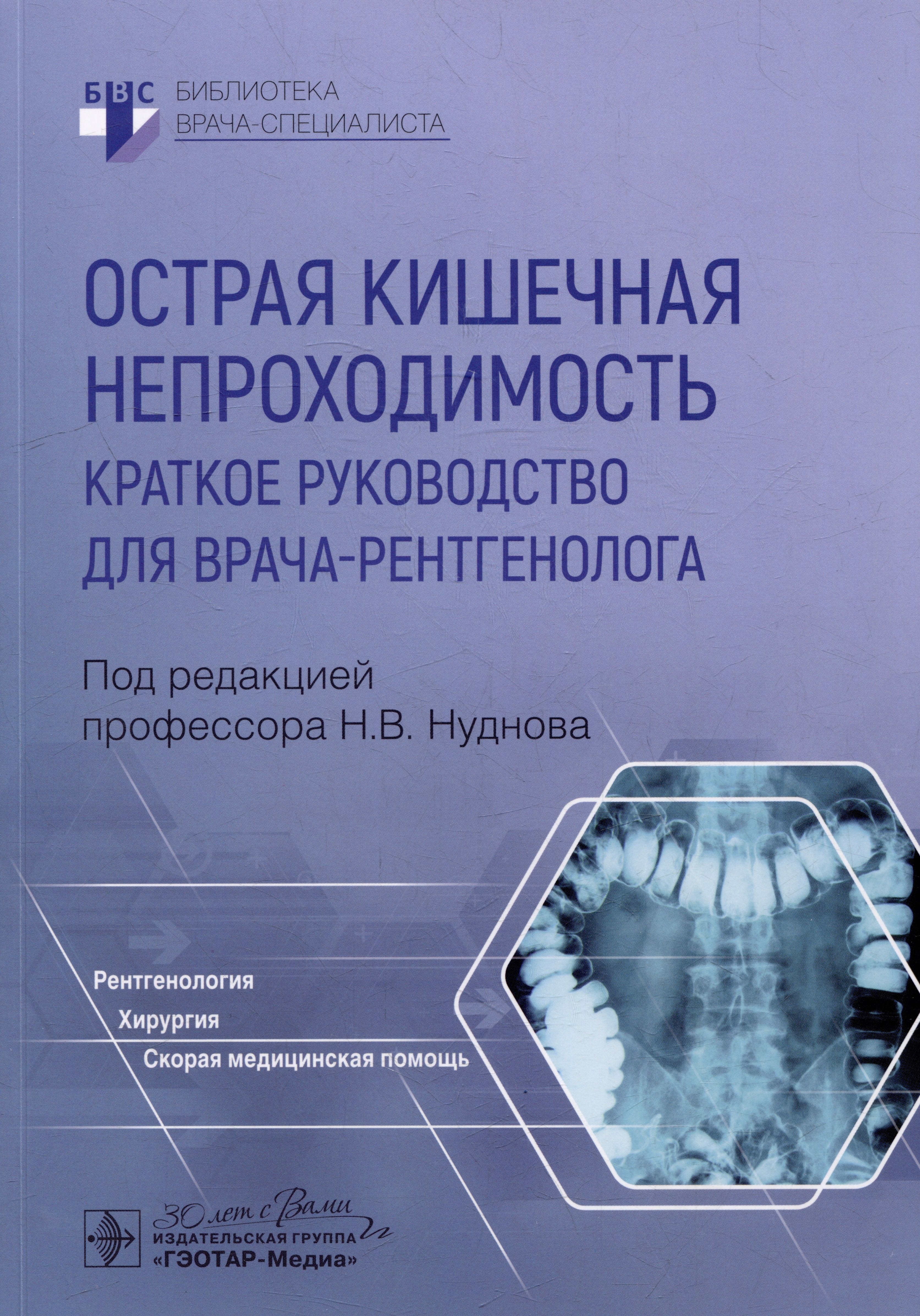 

Острая кишечная непроходимость. Краткое руководство для врача-рентгенолога