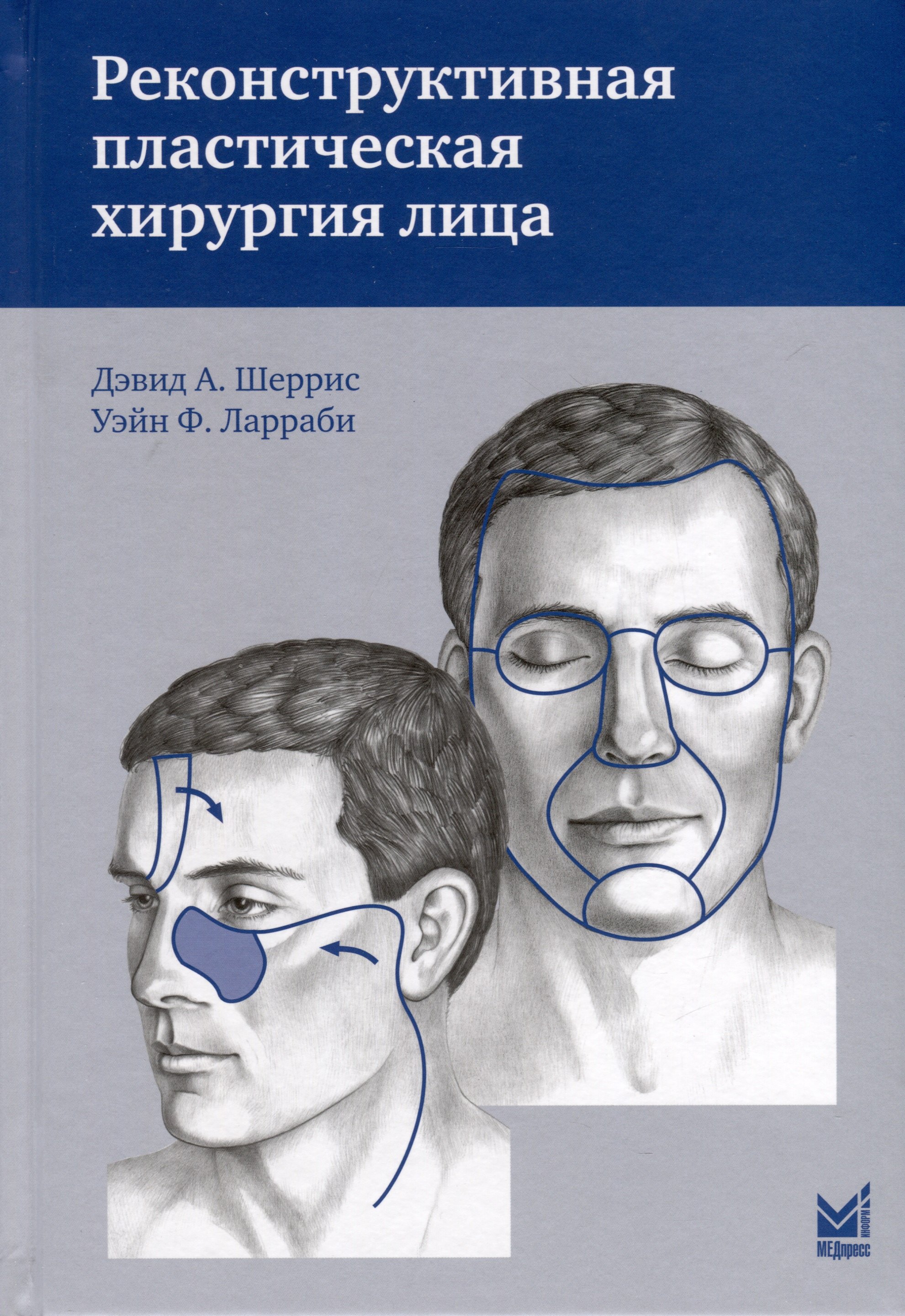 

Реконструктивная пластическая хирургия лица
