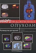

Нейроэндокринные опухоли: руководство для врачей: [пер. с англ.]