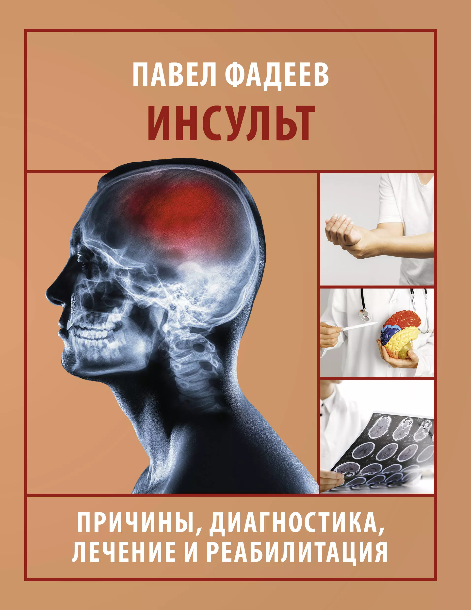 Фадеев Павел Александрович Инсульт. Причины, диагностика, лечение и реабилитация