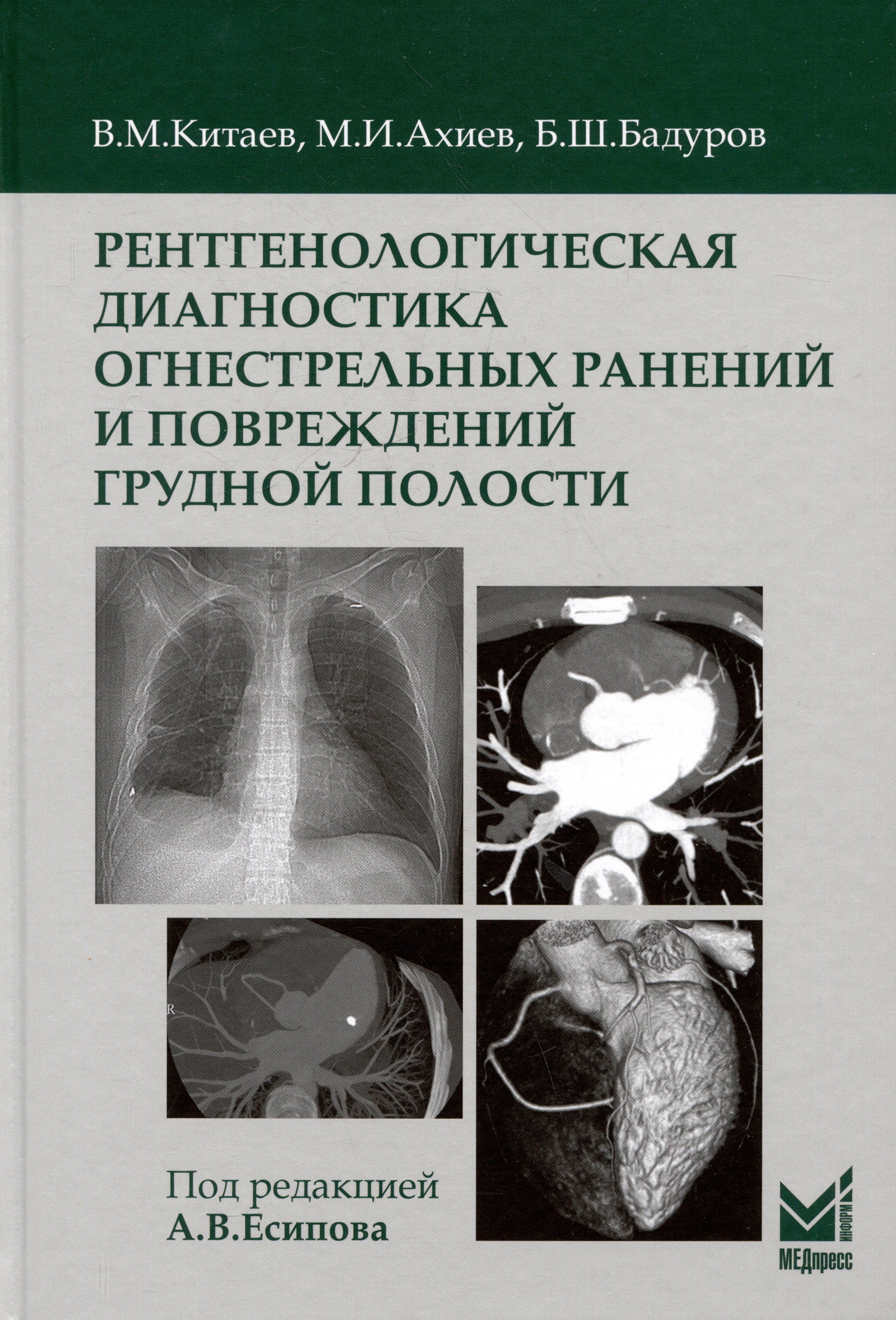 Рентгенологическая диагностика огнестрельных ранений и повреждений грудной полости