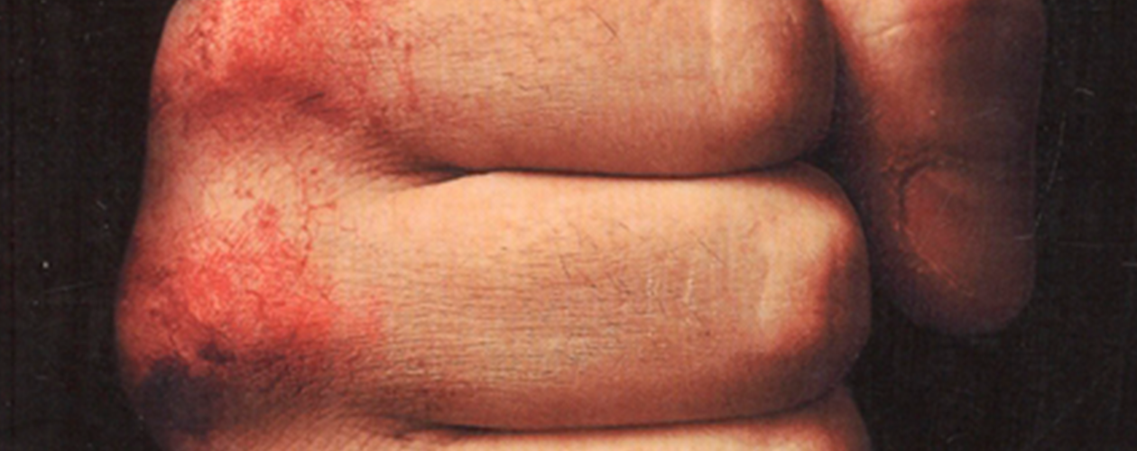 Бойцовский клуб