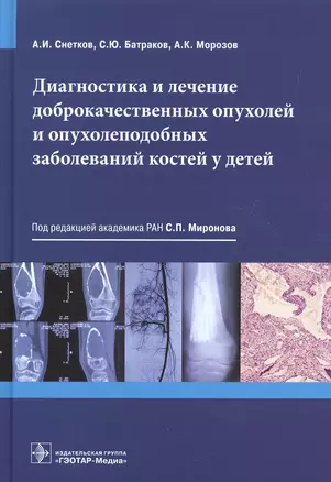 Диагностика и лечение доброкачественных опухолей и опухолеподобных заболеваний костей у детей — 2602510 — 1