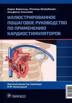 Иллюстрированное пошаговое руководство по применению кардиостимуляторов — 2902641 — 1