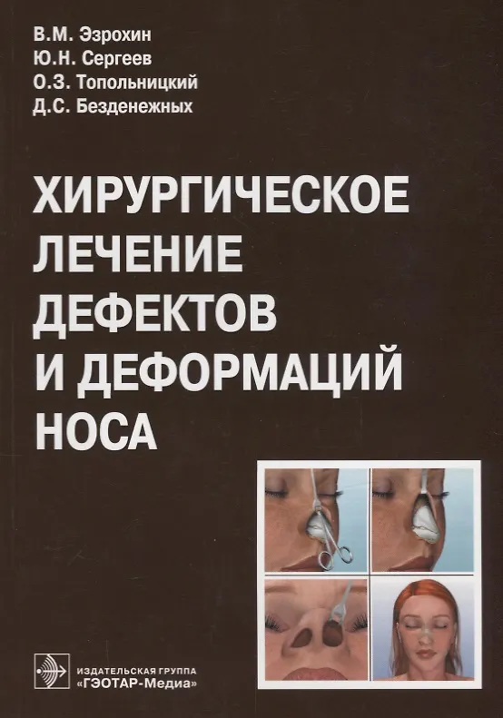 Книга Хирургическое лечение дефектов и деформаций носа () — 1