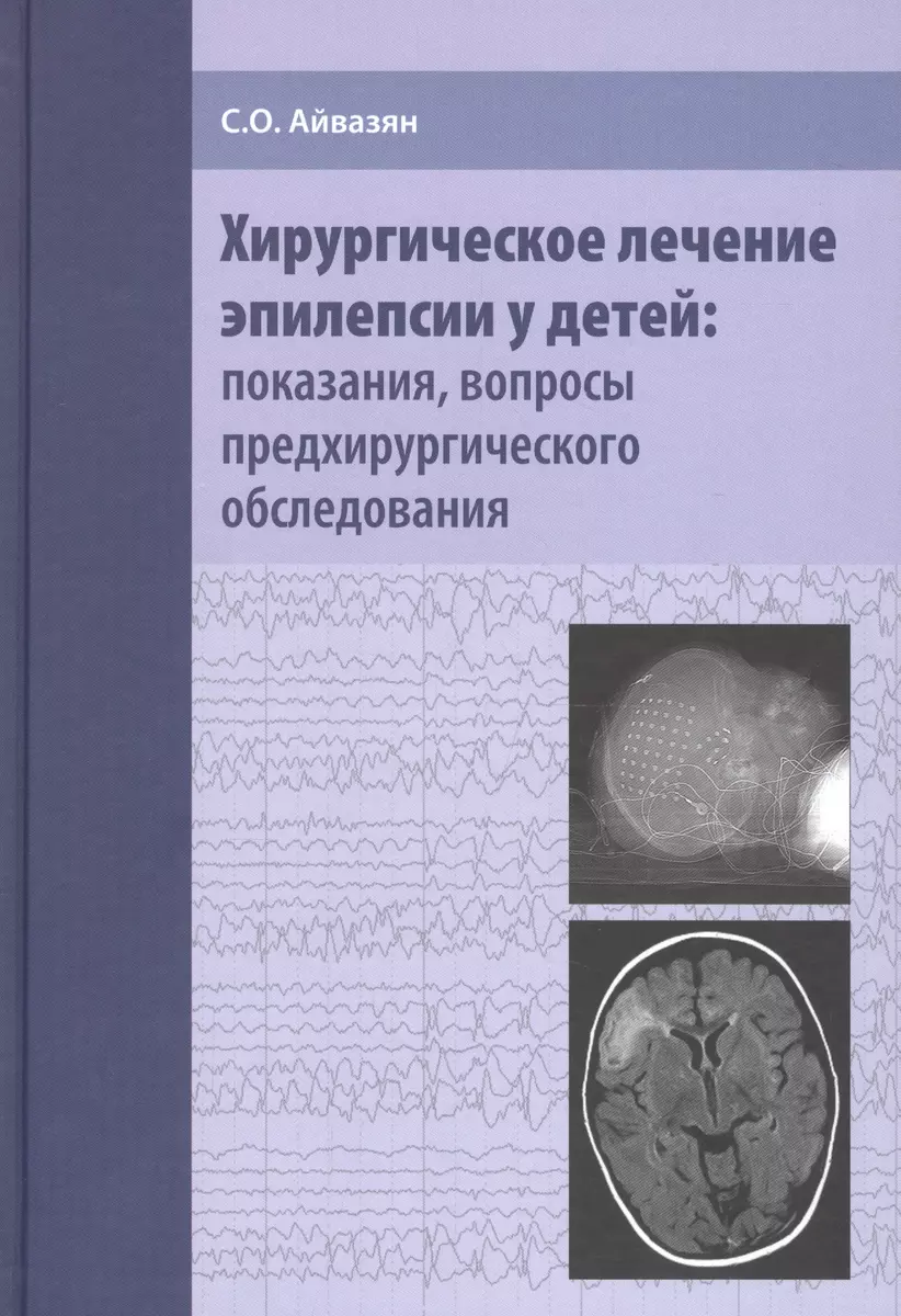 Хирургическое лечение эпилепсии у детей: показания, вопросы  предхирургического обследования (Сергей Айвазян) - купить книгу с доставкой  в ...