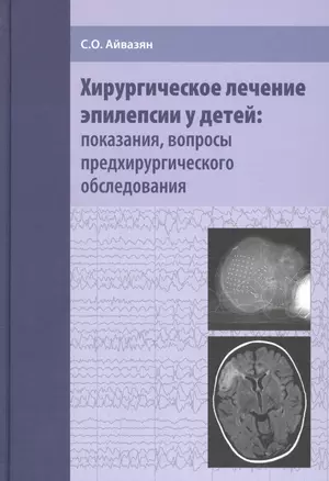 Хирургическое лечение эпилепсии у детей: показания, вопросы предхирургического обследования — 2675746 — 1