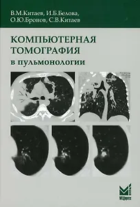 Компьютерная томография в пульмонологии