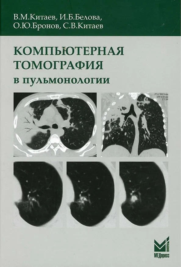 Книга Компьютерная томография в пульмонологии (Вячеслав Китаев) — 1