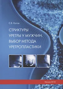 Стриктуры уретры у мужчин. Выбор метода уретропластики