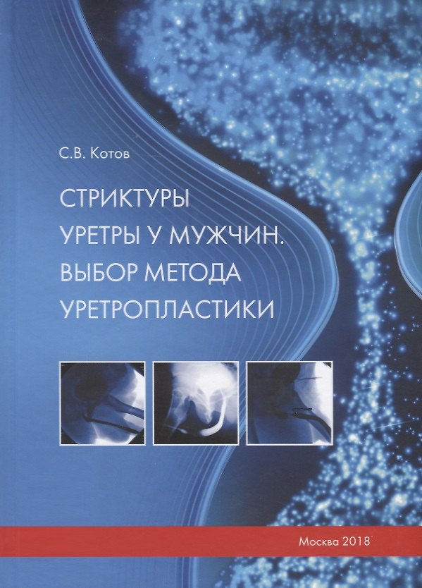 Книга Стриктуры уретры у мужчин. Выбор метода уретропластики (Сергей Котов) — 1