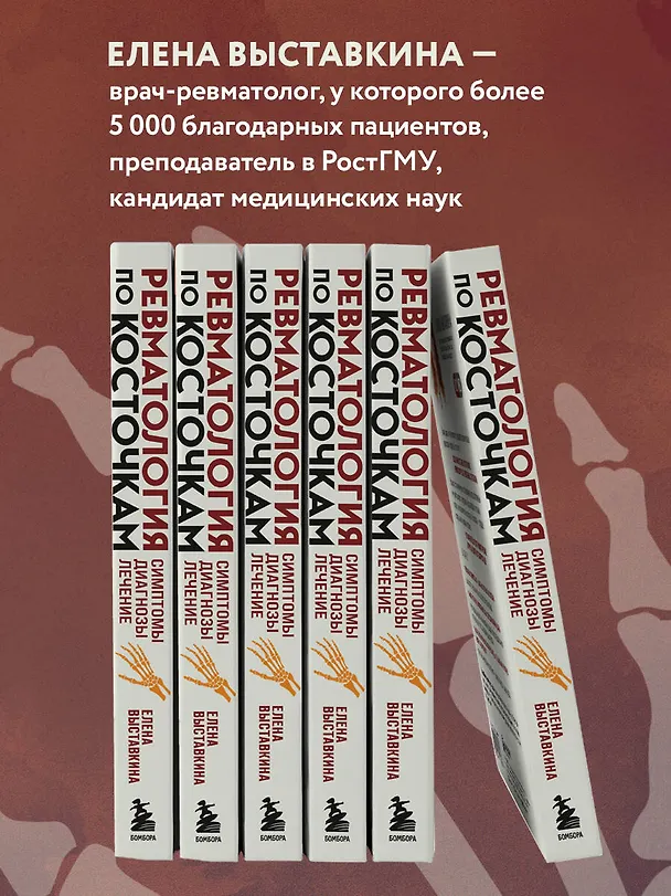 Книга Ревматология по косточкам. Симптомы, диагнозы, лечение (Елена Выставкина) — 7