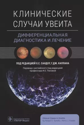 Клинические случаи увеита. Дифференциальная диагностика и лечение — 2962083 — 1