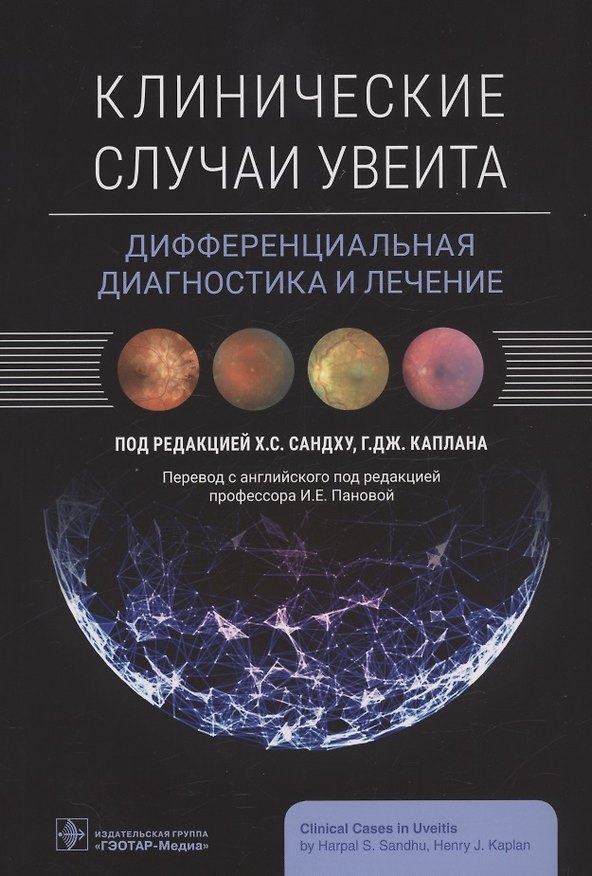 Книга Клинические случаи увеита. Дифференциальная диагностика и лечение () — 1