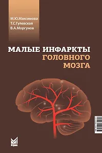Малые инфаркты головного мозга