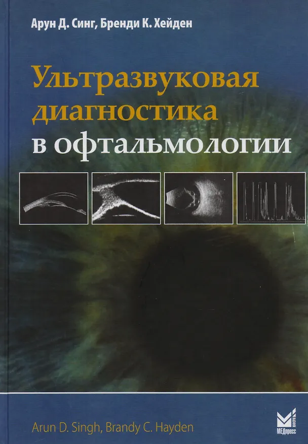 Книга Ультразвуковая диагностика в офтальмологии () — 1