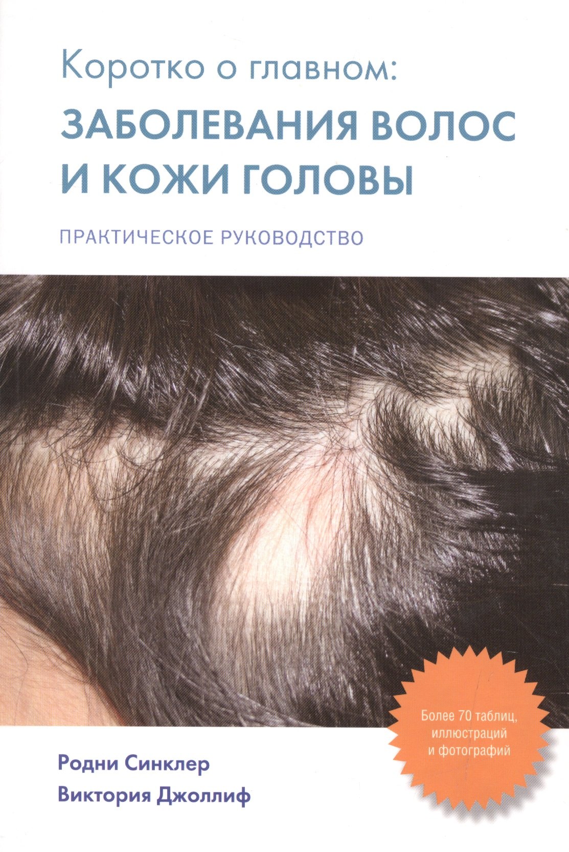 

Коротко о главном: заболевания волос и кожи головы: практическое руководство