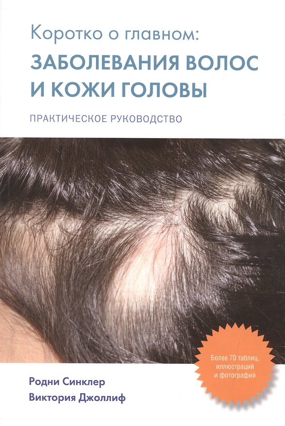 Книга Коротко о главном: заболевания волос и кожи головы: практическое руководство () — 1