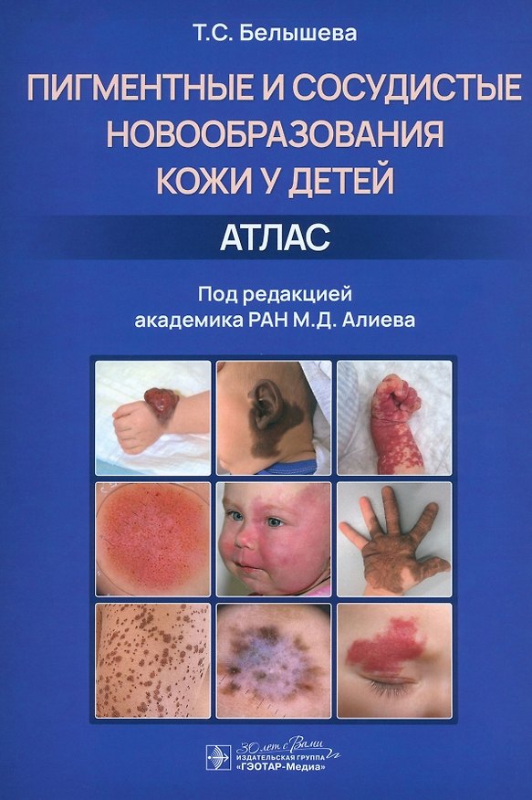 Книга Пигментные и сосудистые новообразования кожи у детей. Атлас (Татьяна Белышева) — 1