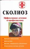 Книга Сколиоз (Алексей Кириллов)