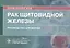Рак щитовидной железы: руководство для врачей — 2814374 — 1
