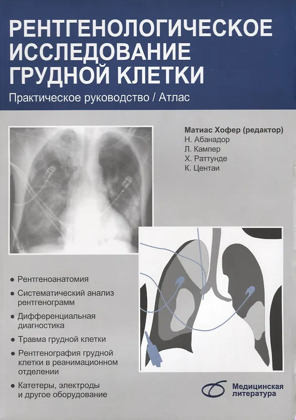 Книга Рентгенологическое исследование грудной клетки (Матиас Хофер) — 1