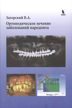 Ортопедическое лечение заболеваний пародонта — 2469440 — 1