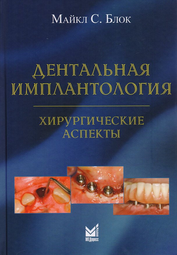 Книга Дентальная имплантология:хирургические аспекты (Майкл С. Блок) — 1