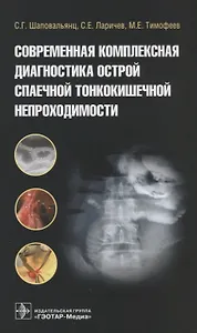 Современная комплексная диагностика острой спаечной тонкокишечной непроходимости