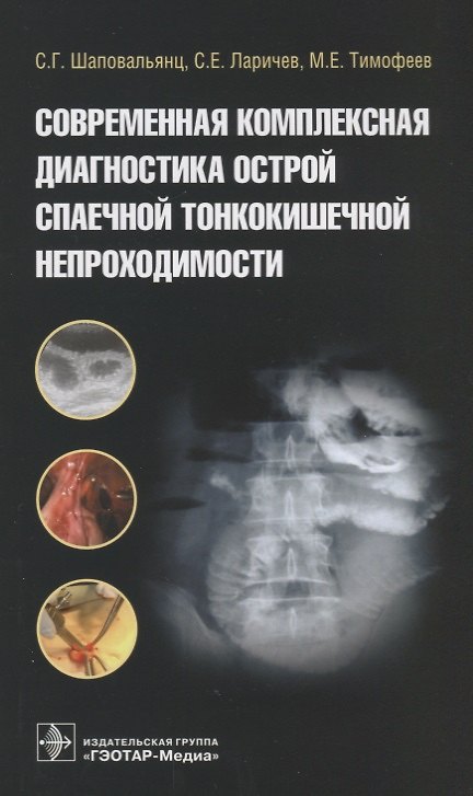 Книга Современная комплексная диагностика острой спаечной тонкокишечной непроходимости () — 1