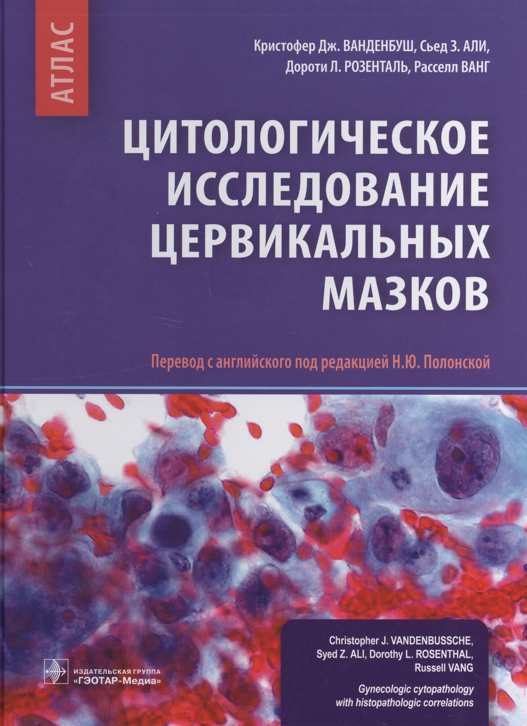 

Цитологическое исследование цервикальных мазков Атлас (Ванденбуш)