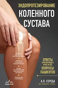 Эндопротезирование коленного сустава: ответы практикующего врача на все вопросы пациентов