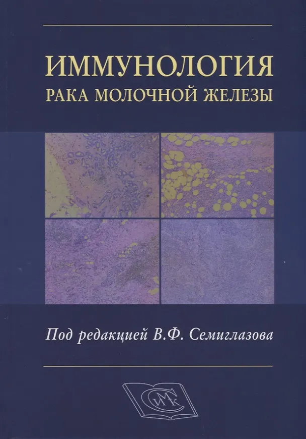 Книга Иммунология рака молочной железы () — 1