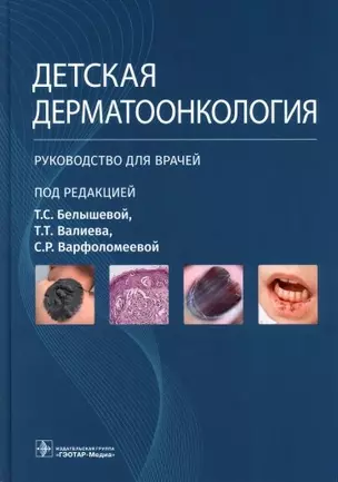 Детская дерматоонкология. Руководство для врачей — 2970579 — 1