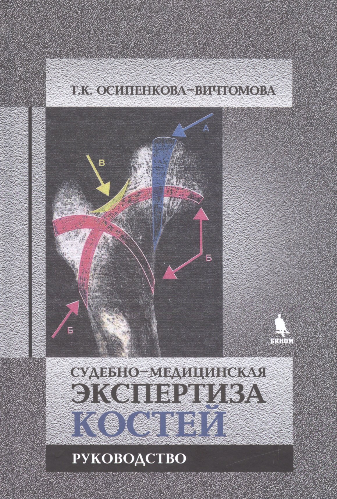 

Судебно-медицинская экспертиза костей