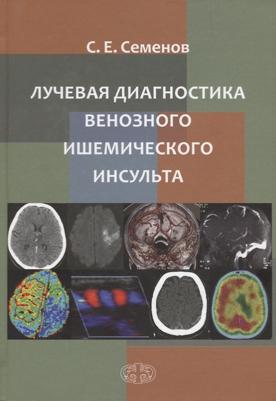 Книга Лучевая диагностика венозного ишемического инсульта (Станислав Семенов) — 1