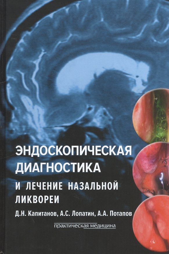 Книга Эндоскопическая диагностика и лечение назальной ликвореи (Андрей Лопатин, Дмитрий Капитанов, Александр Потапов) — 1