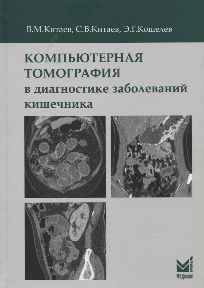 

Компьютерная томография в диагностике заболеваний кишечника