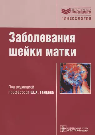 Заболевания шейки матки: руководство — 2638070 — 1