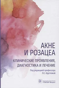 Акне и розацеа. Клинические проявления, диагностика и лечение