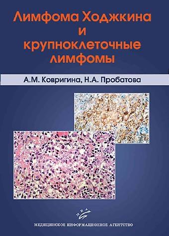Книга Лимфома Ходжкина и крупноклеточные лимфомы. Ковригина А. (Икс) () — 1