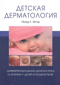 Детская дерматология. Дифференциальная диагностика и лечение у детей и подростков