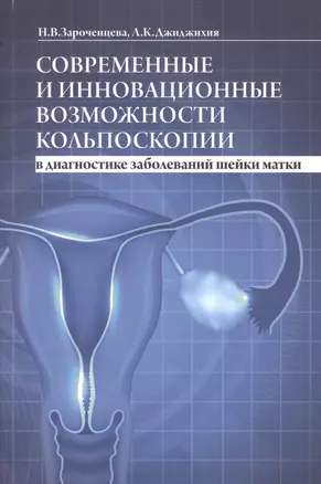 Современные и инновационные возможности кольпоскопии в диагностике заболеваний шейки матки — 2701587 — 1