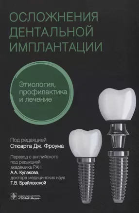 Осложнения дентальной имплантации. Этиология, профилактика и лечение — 2818094 — 1