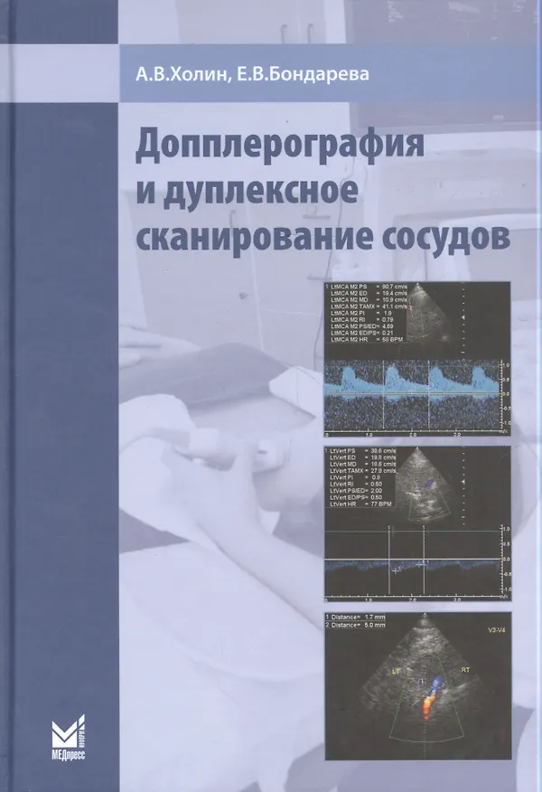 Книга Допплерография и дуплексное сканирование сосудов (Александр Холин) — 3