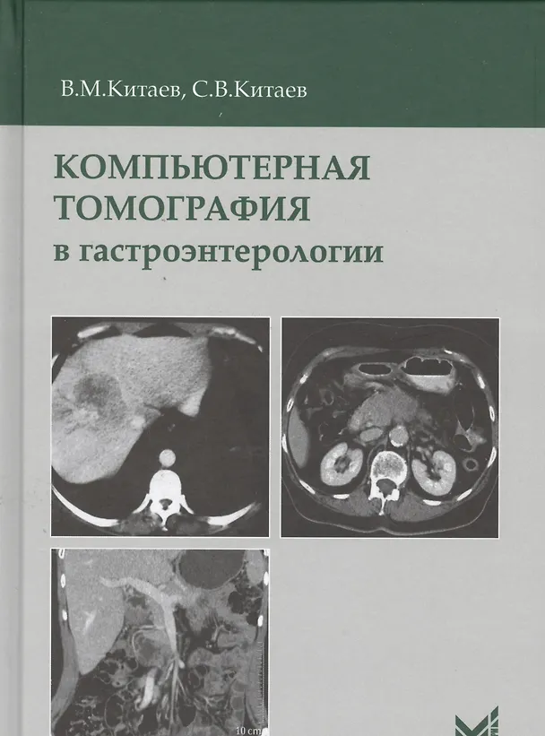 Книга Компьютерная томография в гастроэнтерологии (Вячеслав Китаев) — 1