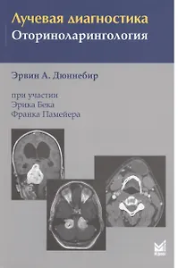 Лучевая диагностика. Оториноларингология